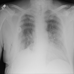 1.2.276.0.7230010.3.1.4.8323329.1085.1517875166.265258